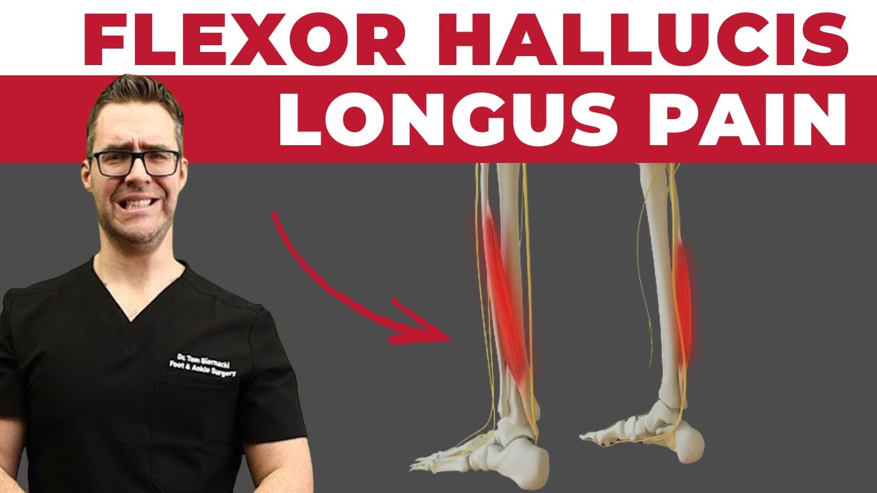 Flexor Hallucis Longus PAIN [FHL Tendonitis BEST Treatment!]