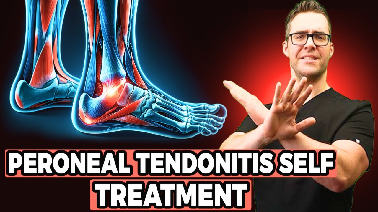 Peroneal Tendonitis Self Treatment — Michigan Foot Doctors