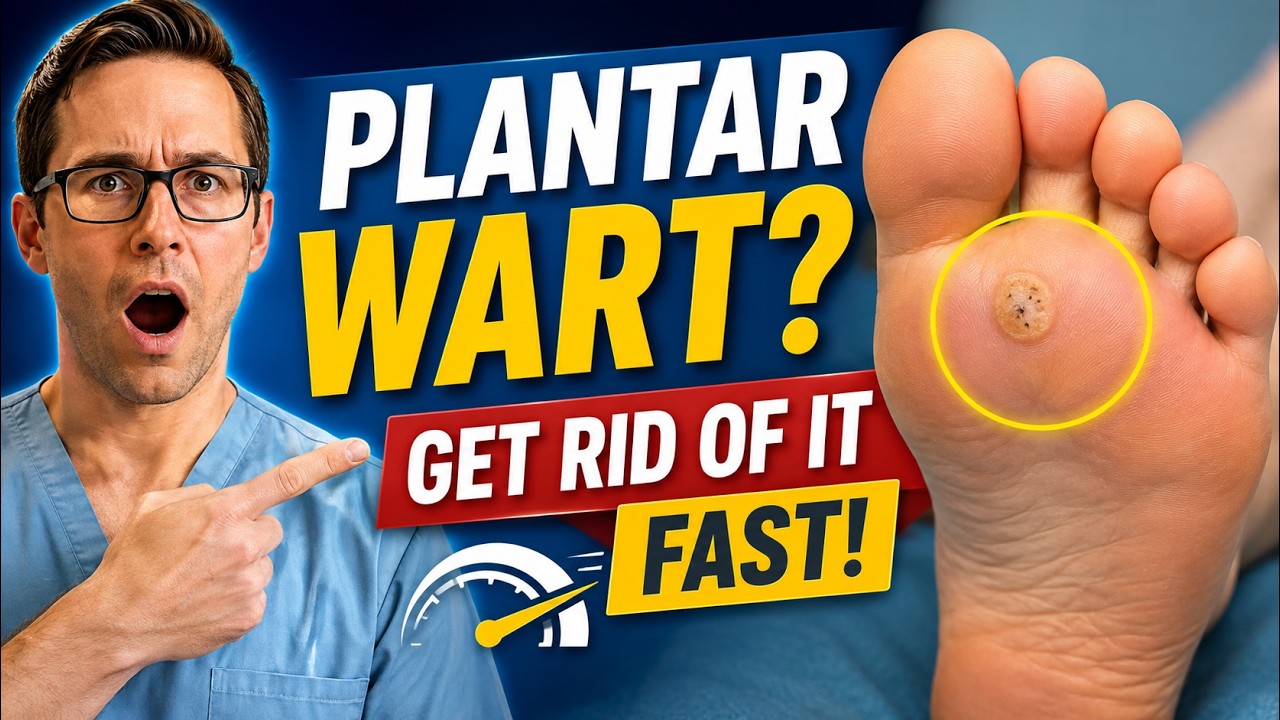 Do You Have a Plantar Wart? Here Is How to Get Rid of It Fast