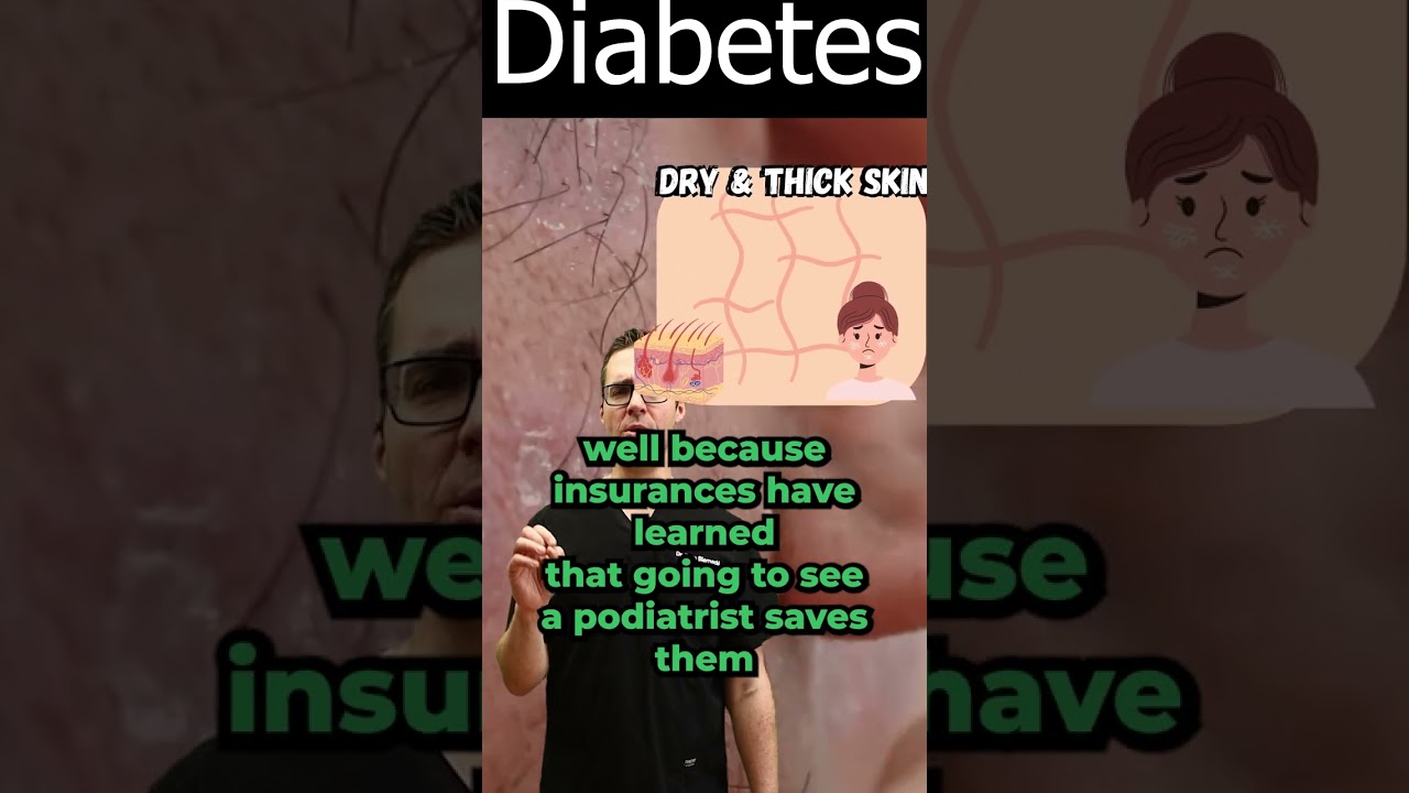 Thick Dead Skin on Feet & Dry Skin on Feet [Diabetes Skin Conditions]